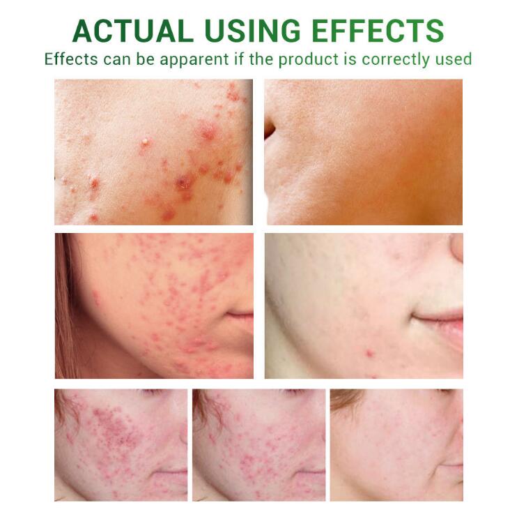 Scar Repair Essential Oil – Nourishing Skin Care Serum for Smooth & Healthy-Looking Skin