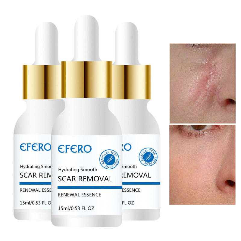 Acne Scar Repair & Firming Serum