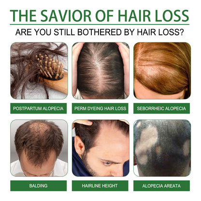 Rosemary Hair Growth & Scalp Essential Oil