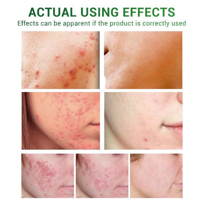 Scar Repair Essential Oil – Nourishing Skin Care Serum for Smooth & Healthy-Looking Skin