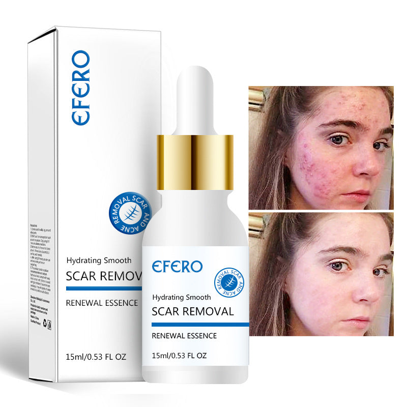 Acne Scar Repair & Firming Serum