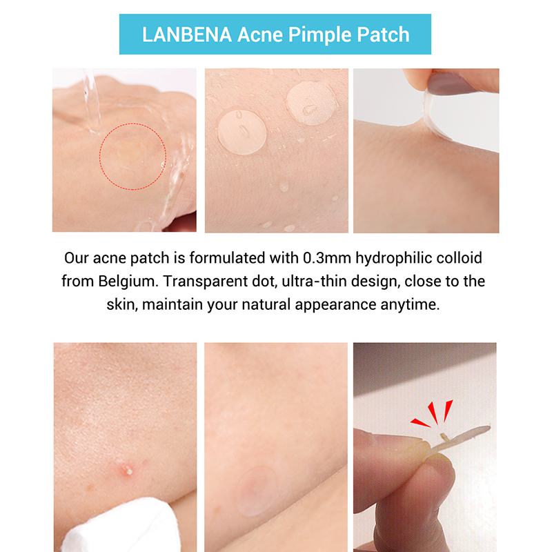 Tea Tree Acne Spot Patches