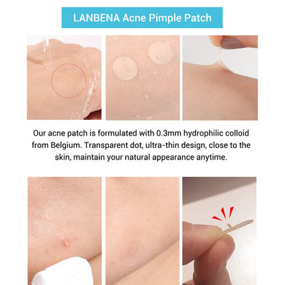Tea Tree Acne Spot Patches