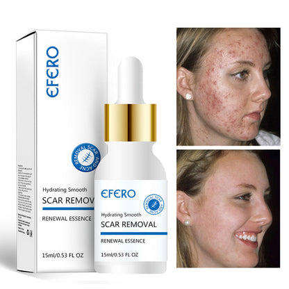Acne Scar Repair & Firming Serum